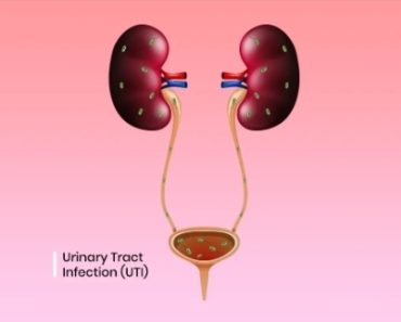4 Foods That Can Clear Infections And Cleanse The Urinary Tract