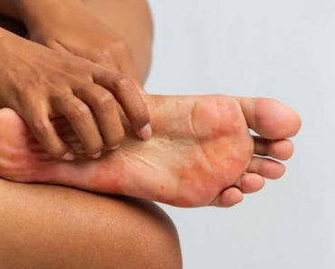 Diabetes and Your Feet: 5 Warning Signs Of Foot Problems Due to High Blood Sugar Level