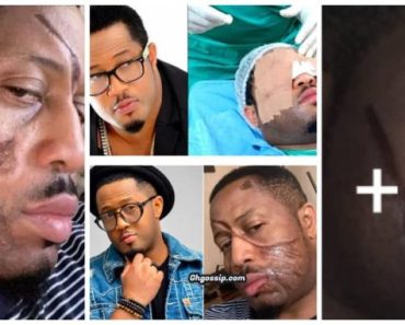 JUST IN: Nollywood Actor Mike Ezuruonye recounts how he escaped ‘permanent blindness’, calls for prayers