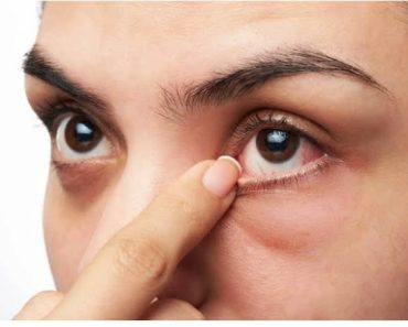 Warning: Foods That Slowly Damage The Eyes If Consumed Regularly