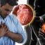 4 Heart Attack Symptoms That Are Silent but Deadly