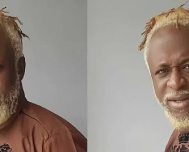 REAL LIFE STORY: “I Was Poisoned As A Child” – Veteran Singer, Tony Tetuila Reveals What Led His Leg Injury